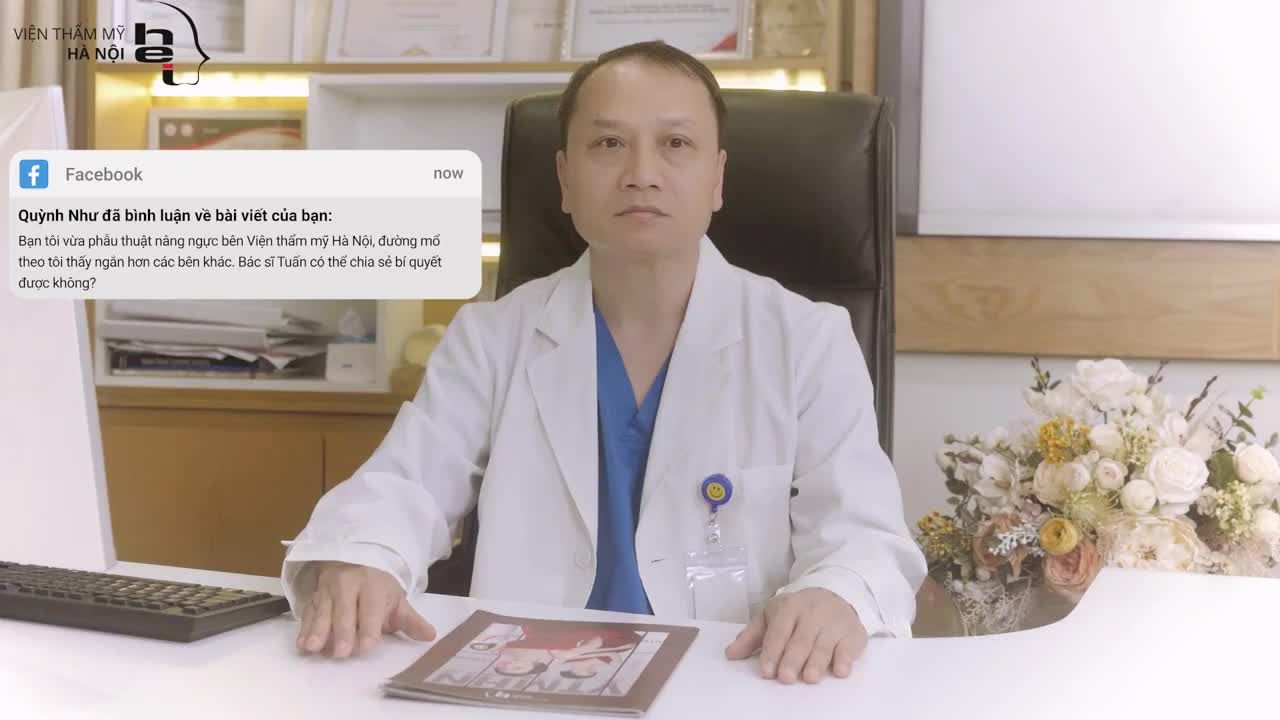 Tại sao nâng ngực tại viện thẩm mỹ Hà Nội đường m.ổ lại rất ngắn và vô cùng mảnh nhỏ?