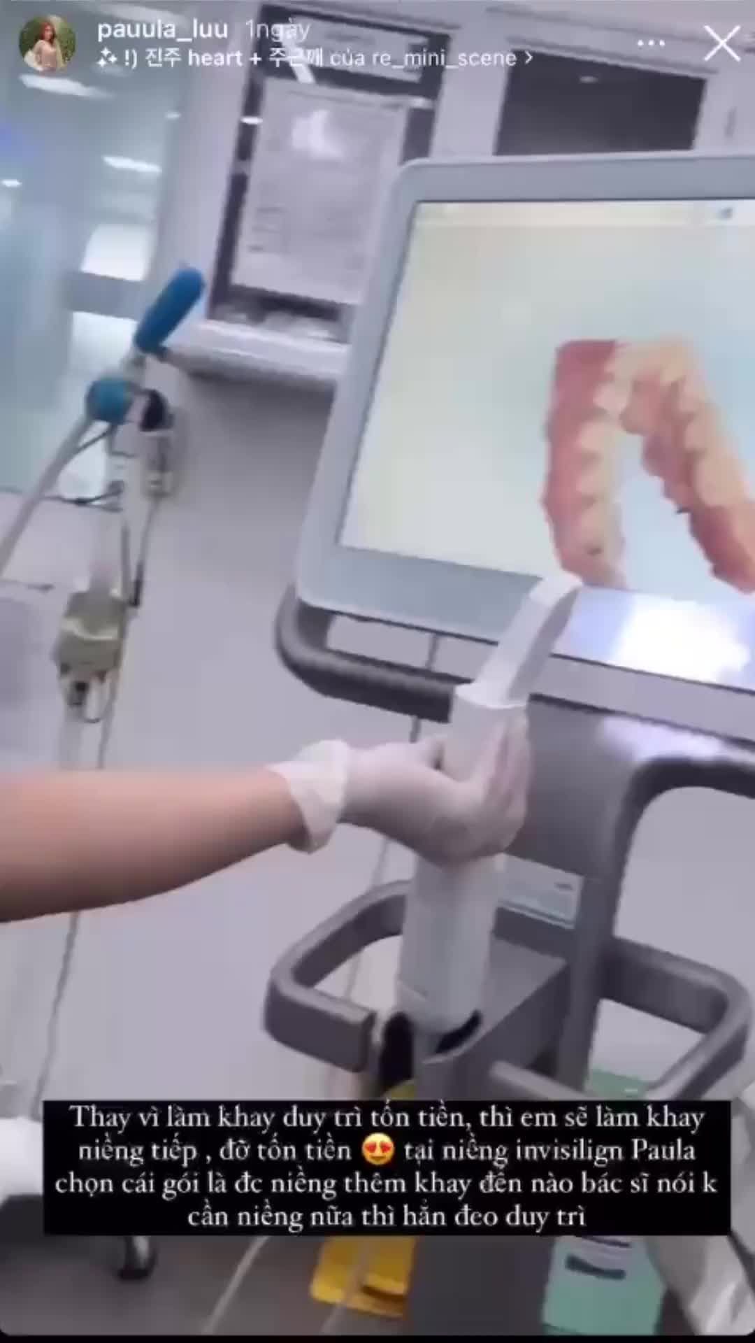 Hot Girl Ái Vy Lưu kết thúc quá trình niềng răng Invisalign tại nha khoa Paris gói Invisalign Comprehensive Plus