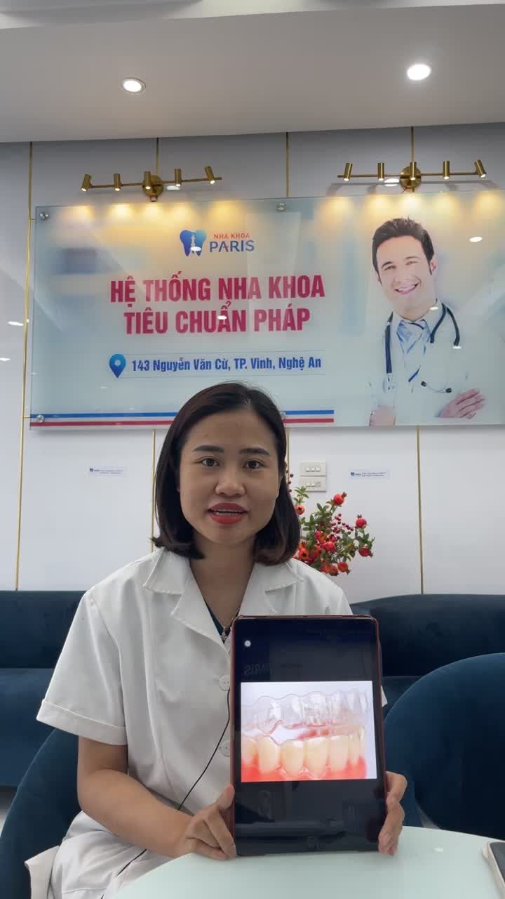 Cần đeo hàm duy trì sau chỉnh nha hay không???