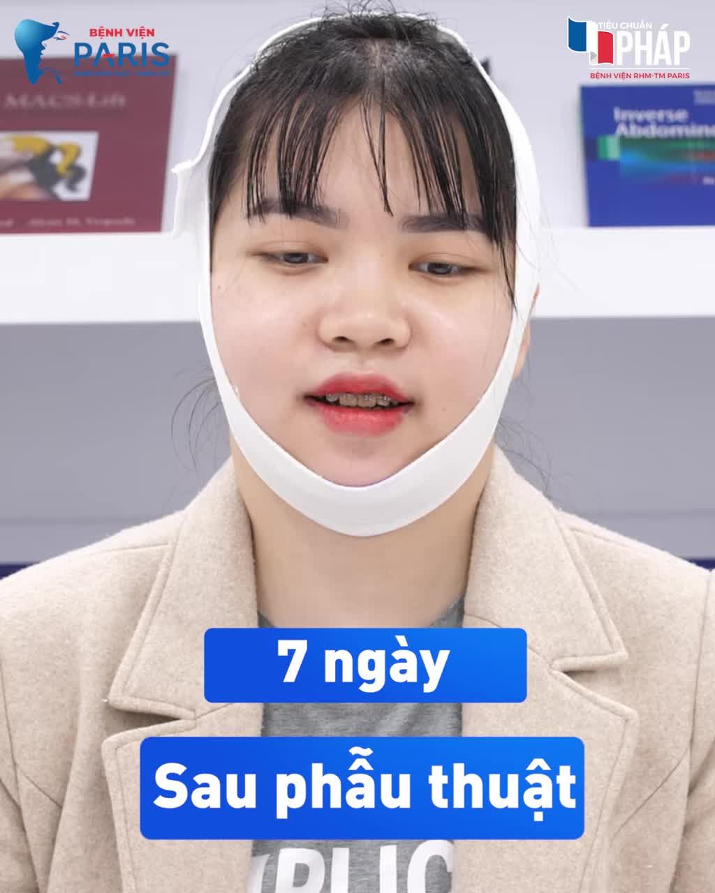 Chỉnh hàm móm thay đổi cuộc đời tôi thế nào?