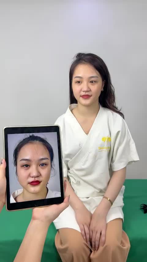 Ca Vline Perfect quay lại tái khám tại TMV Tấm
