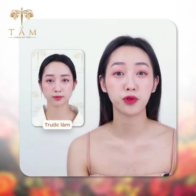 Lí do em chọn Vline Perfect là gì? - Vì em thấy có các chị KOLs làm bên này nhiều lắm