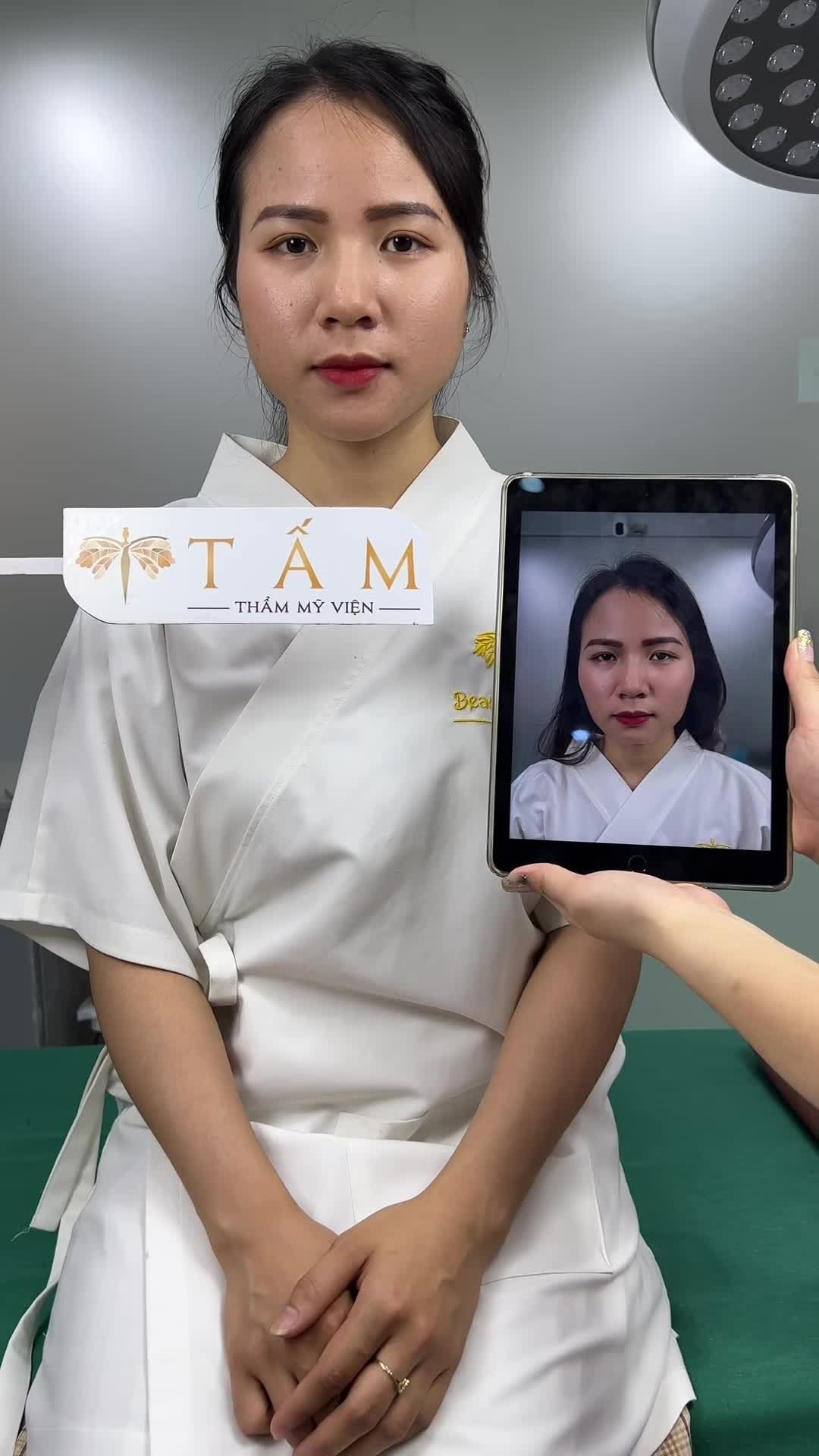 Ca cân chỉnh gương mặt nhờ combo Filler má, cằm tại phòng khám TMV Tấm.