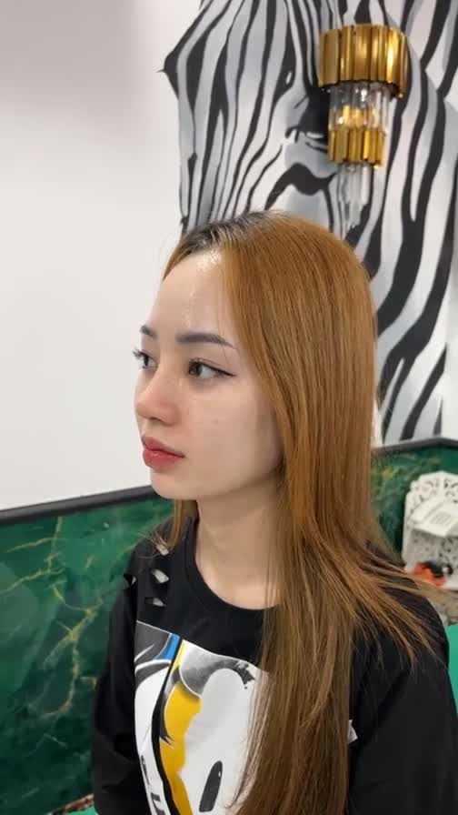 Case mũi cấu trúc được 10 ngày