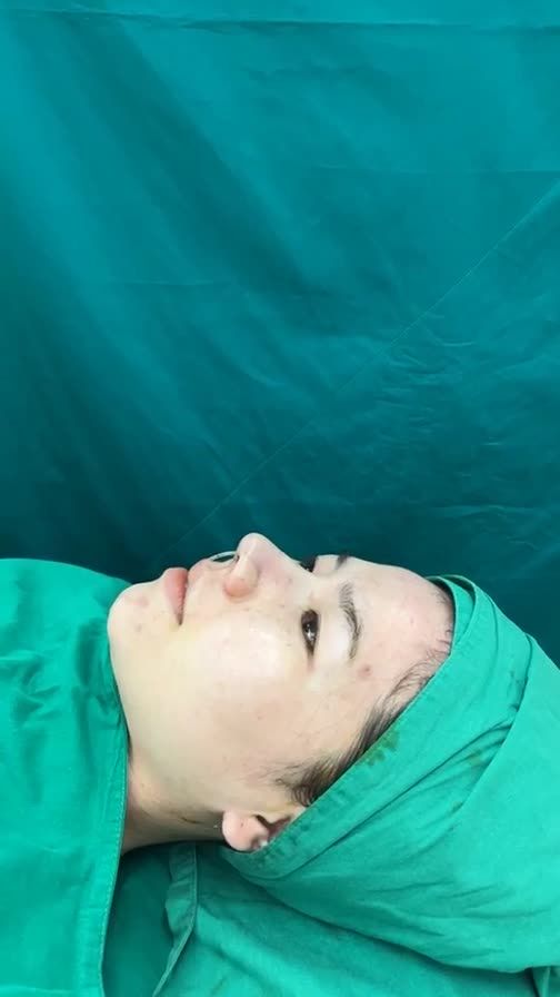 Case mũi cấu trúc vừa hoàn thành