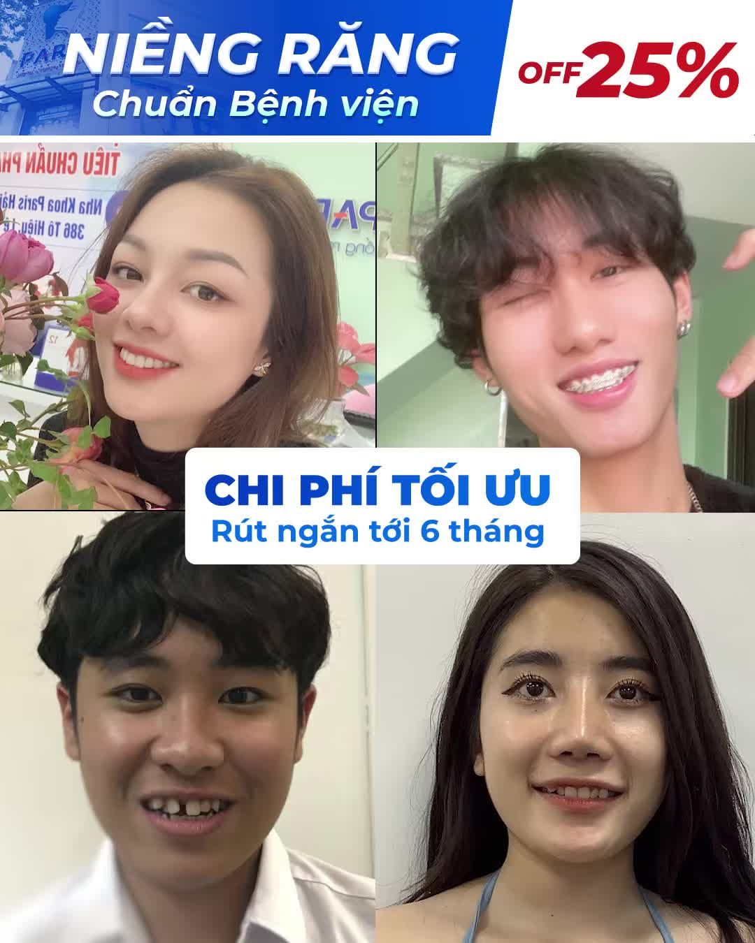 Niềng Răng Chuẩn Bệnh Viện RHM