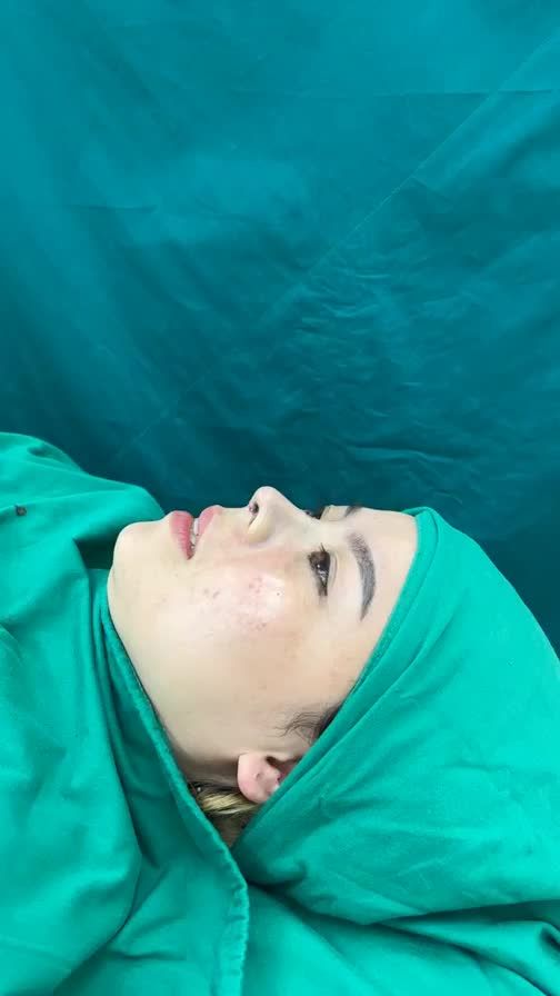 Case mũi cấu trúc vừa hoàn thành