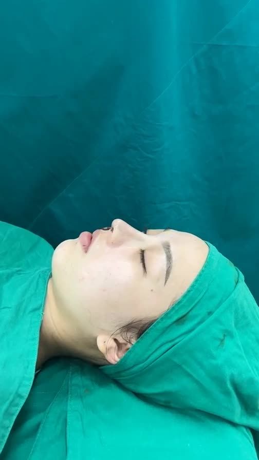Case mũi cấu trúc vừa hoàn thành