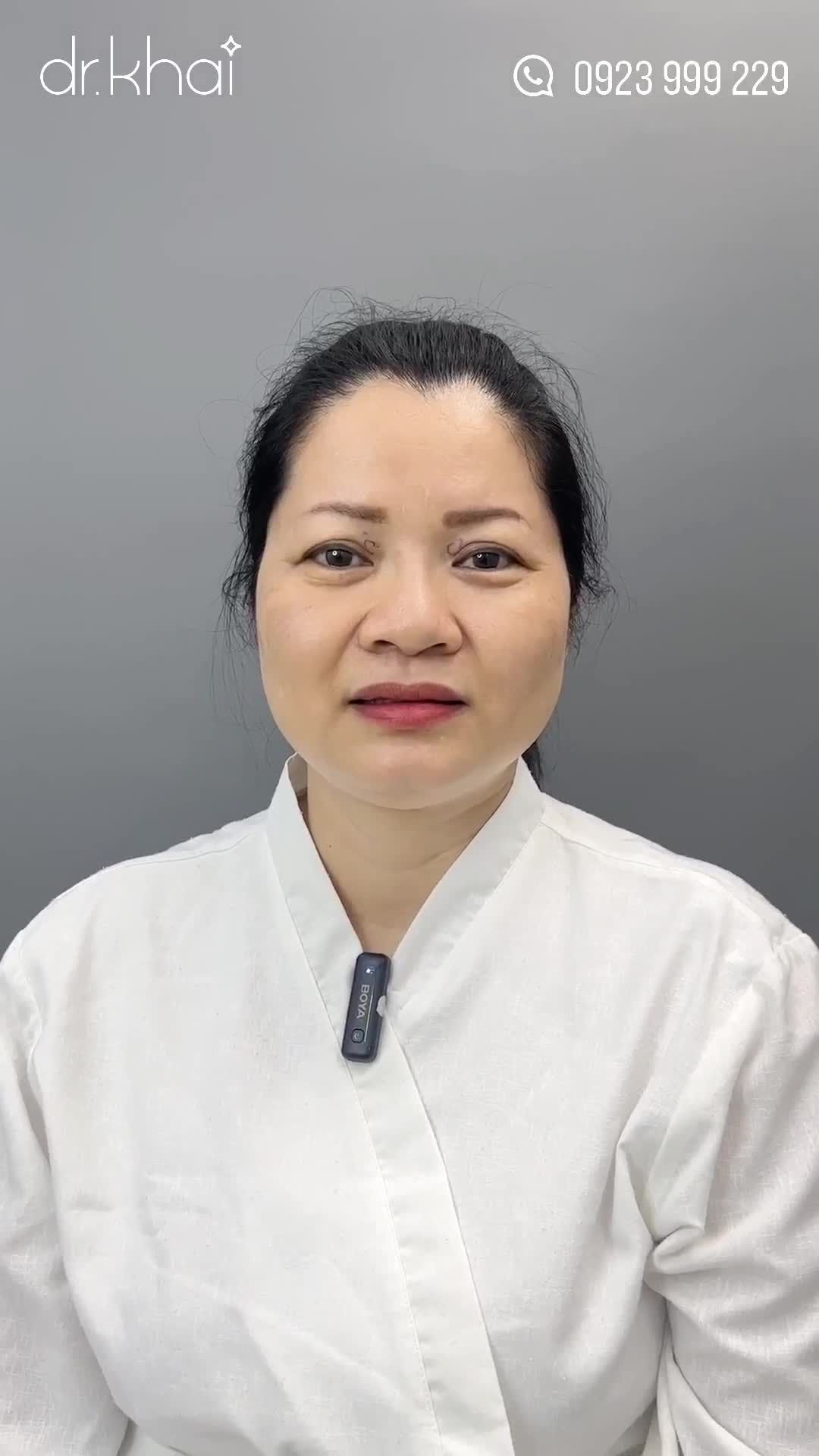 U40 CẮT MÍ LẦN ĐẦU - MONG MUỐN MÍ ĐẸP TỰ NHIÊN