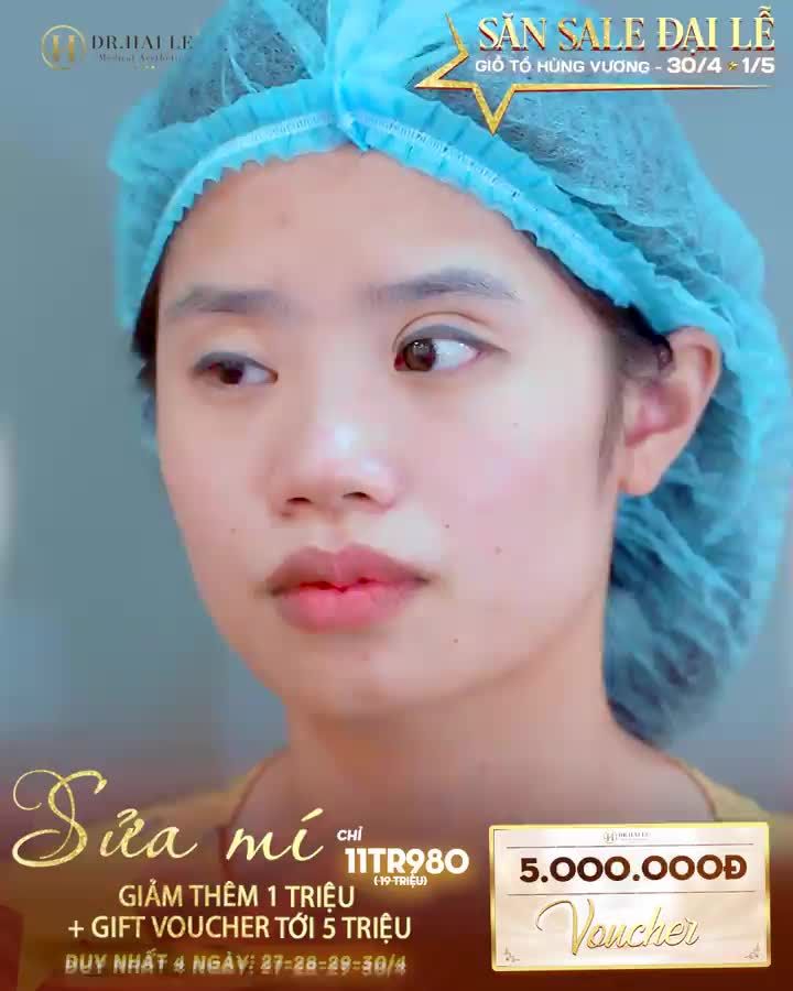 Bạn ấy đã bật  khi nhìn thấy kết quả sau sửa mí tại Dr.Hải Lê......