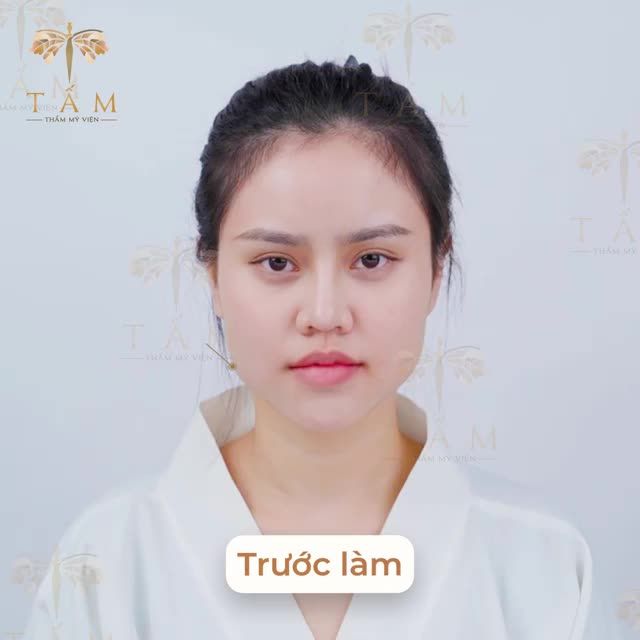 Sở hữu vẻ đẹp nàng thơ, khuôn mặt vline chuẩn hot girl.
