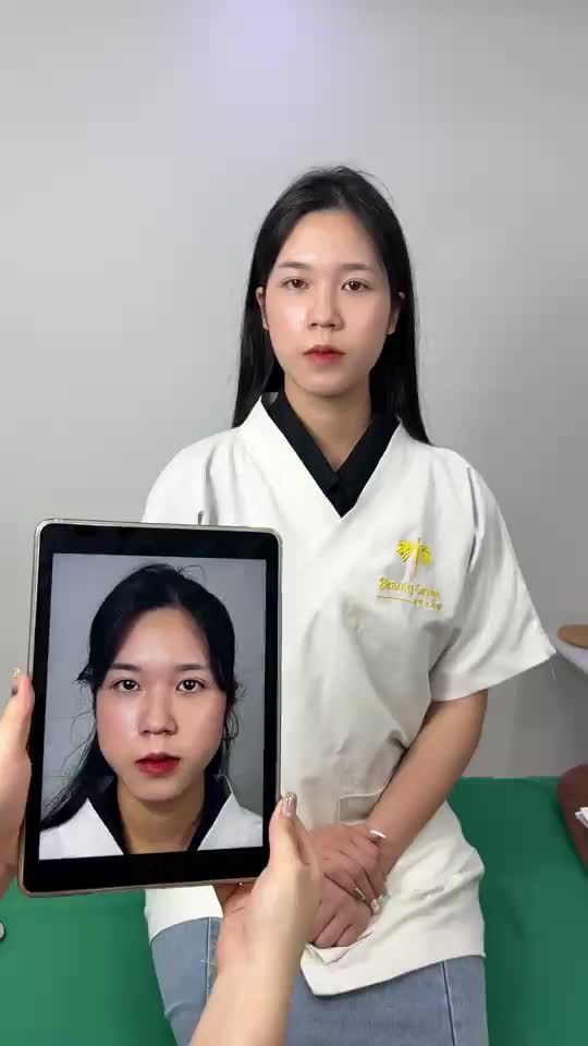Ca Vline Perfect quay lại tái khám tại TMV Tấm