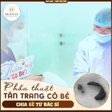 Bác sĩ ơi, làm vùng kín có đau  ạ, chứ em chịu đau kém quá!