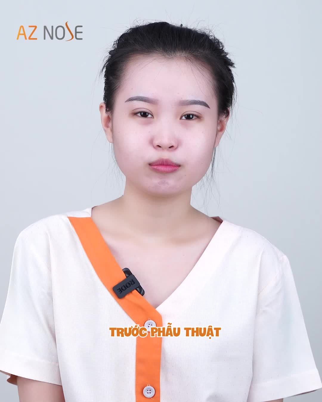 Bạn sẽ làm gì để trở thành cô dâu đẹp nhất trong ngày trọng đại của mình?
