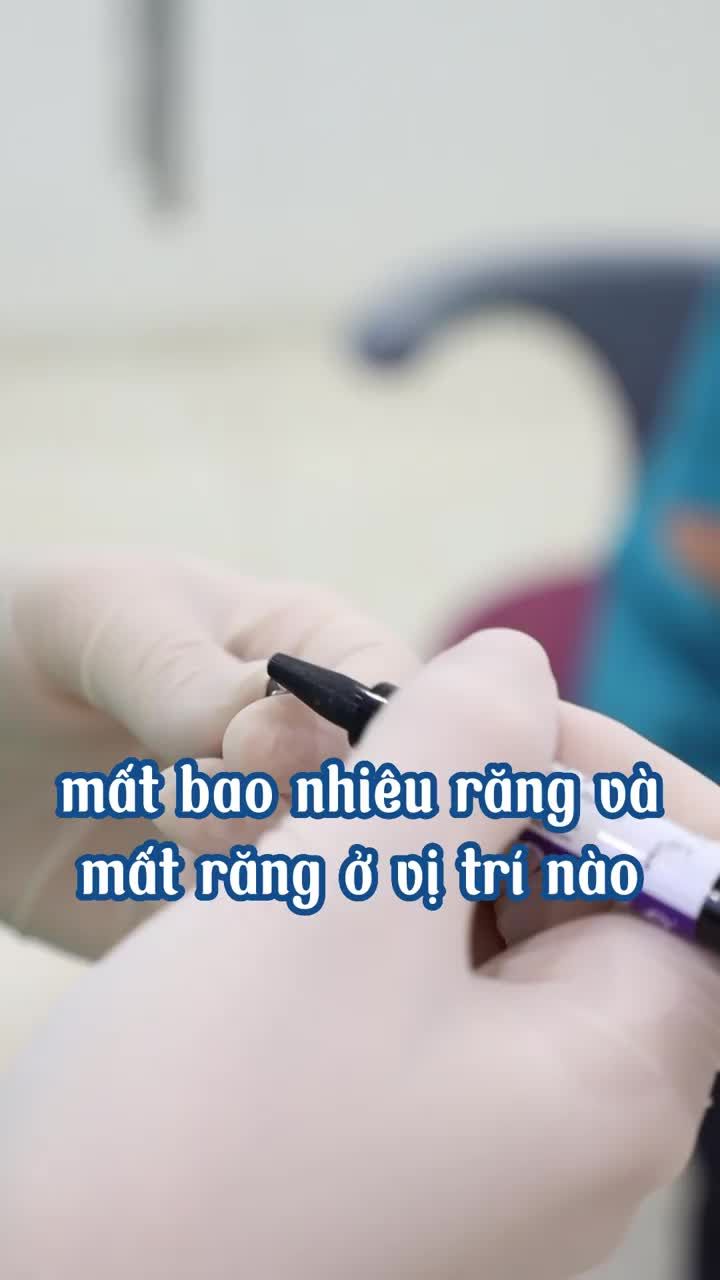 Nên trồng răng hay niềng răng để khắc phục răng đã mất?