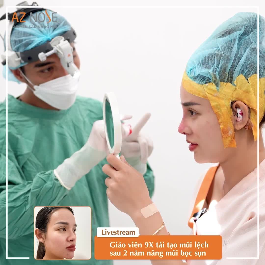 Xem dáng mũi cho khách giáo viên 9X đã làm mí mắt to dày