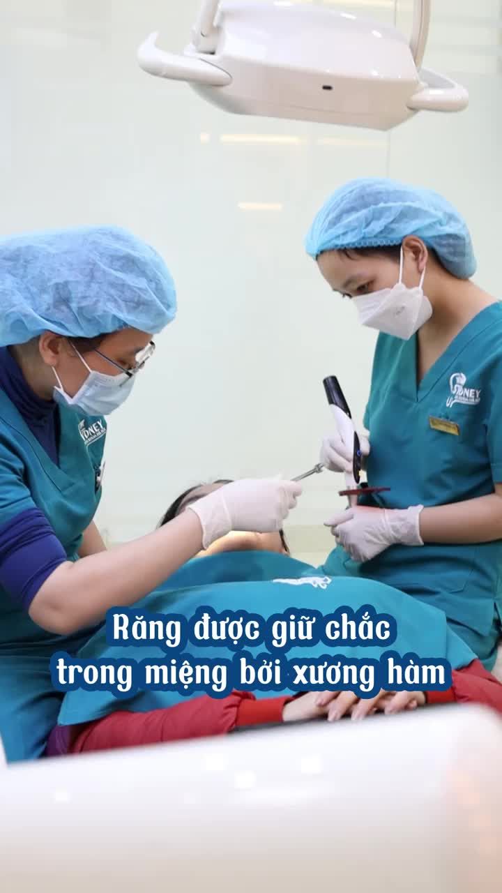 Tại sao niềng răng mất nhiều thời gian?