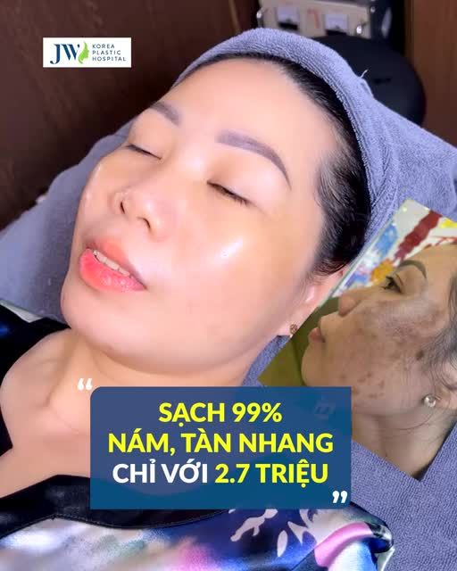 NÁM, ĐỐM NÂU, TÀN NHANG HẾT SẠCH CHỈ VỚI PHƯƠNG PHÁP NÀY