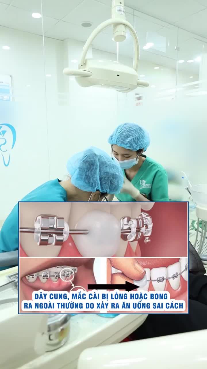 Làm gì khi dây cung, mắc cài bị bong, lỏng?