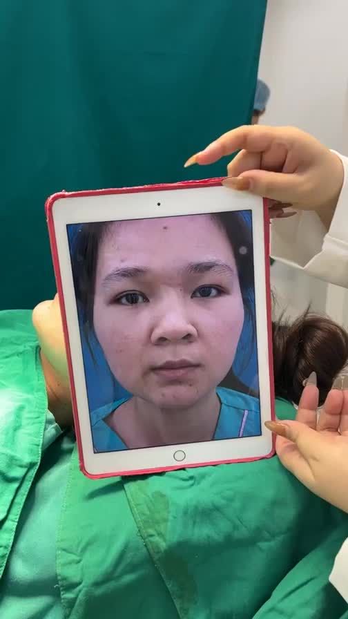 Case mũi cấu trúc vừa hoàn thành