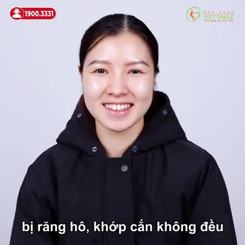 GẮN MẮC CÀI - BẮT ĐẦU HÀNH TRÌNH NIỀNG RĂNG HÔ