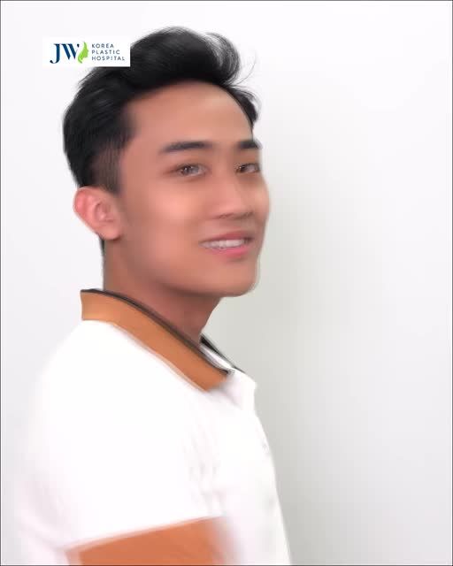 NIỀNG RĂNG TRONG SUỐT AI - ĐỈNH CAO CÔNG NGHỆ NIỀNG RĂNG 2023.