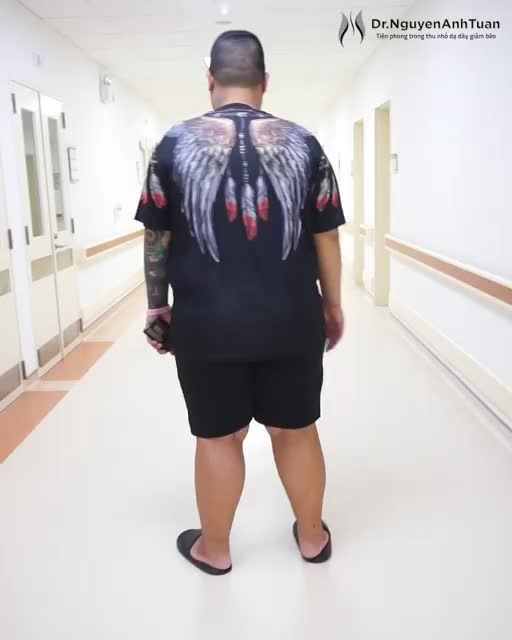 Gần một thập kỷ sống trong thân hình ngập mỡ ( 153kg) , từng thử nhiều phương pháp nhưng bất lực, ngược lại sức khỏe bị ảnh hưởng nghiêm trọng.