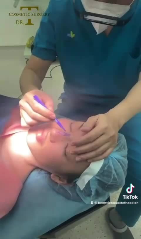 MÀI GỒ SỐNG MŨI LÀ GÌ??
