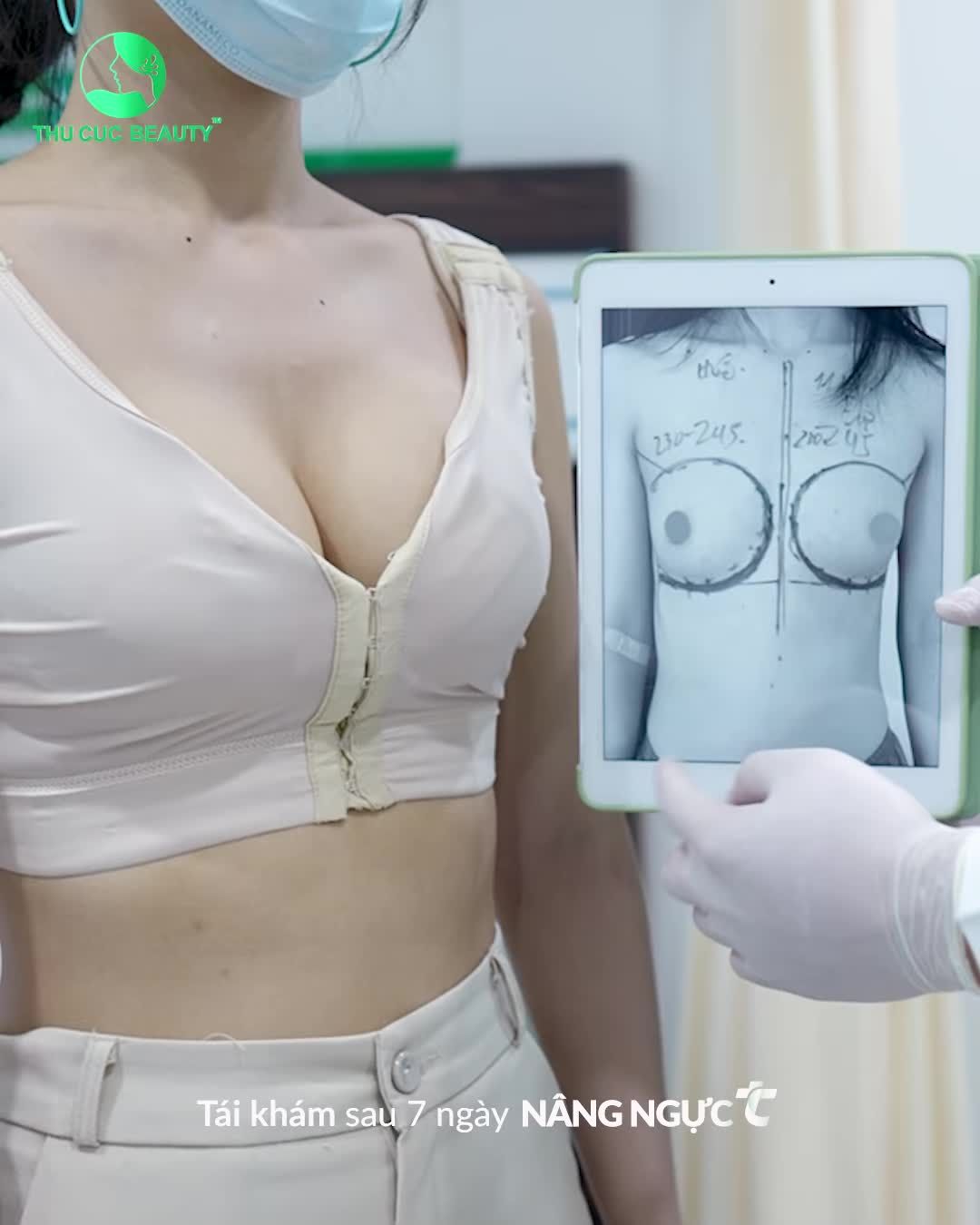Nâng ngực TC - Tự tin diện Bikini