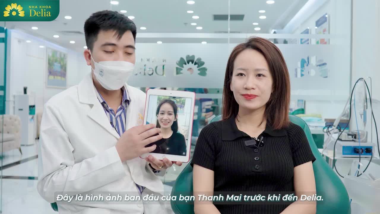 Lắng nghe bác sĩ Vũ Tiến Dũng phân tích nguyên nhân dẫn đến tình trạng và xem kết quả của chị Thanh Mai sau khi sở hữu nụ cười mới khỏe đẹp và trắng sáng.