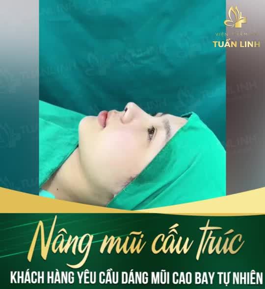 Khoe trọn góc nghiêng ''vạn người mê'' với chiếc mũi cấu trúc siêu xinh.