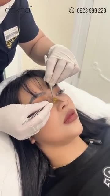 NÂNG MŨI ĐẸP SANG - DUYÊN DÁNG ĐÓN HÈ