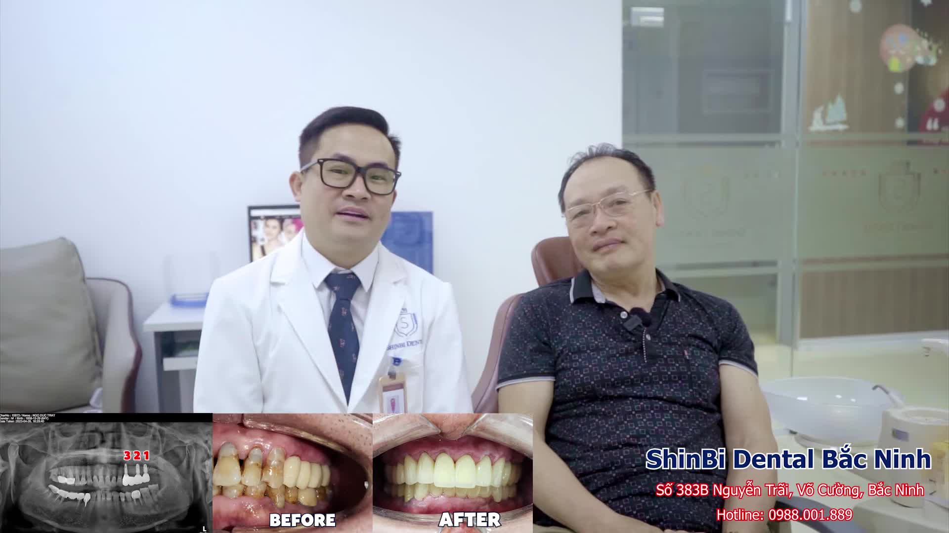 Khách hàng sinh sống 40 năm tại Séc tin tưởng lựa chọn trở về Việt Nam làm răng tại Shinbi Dental