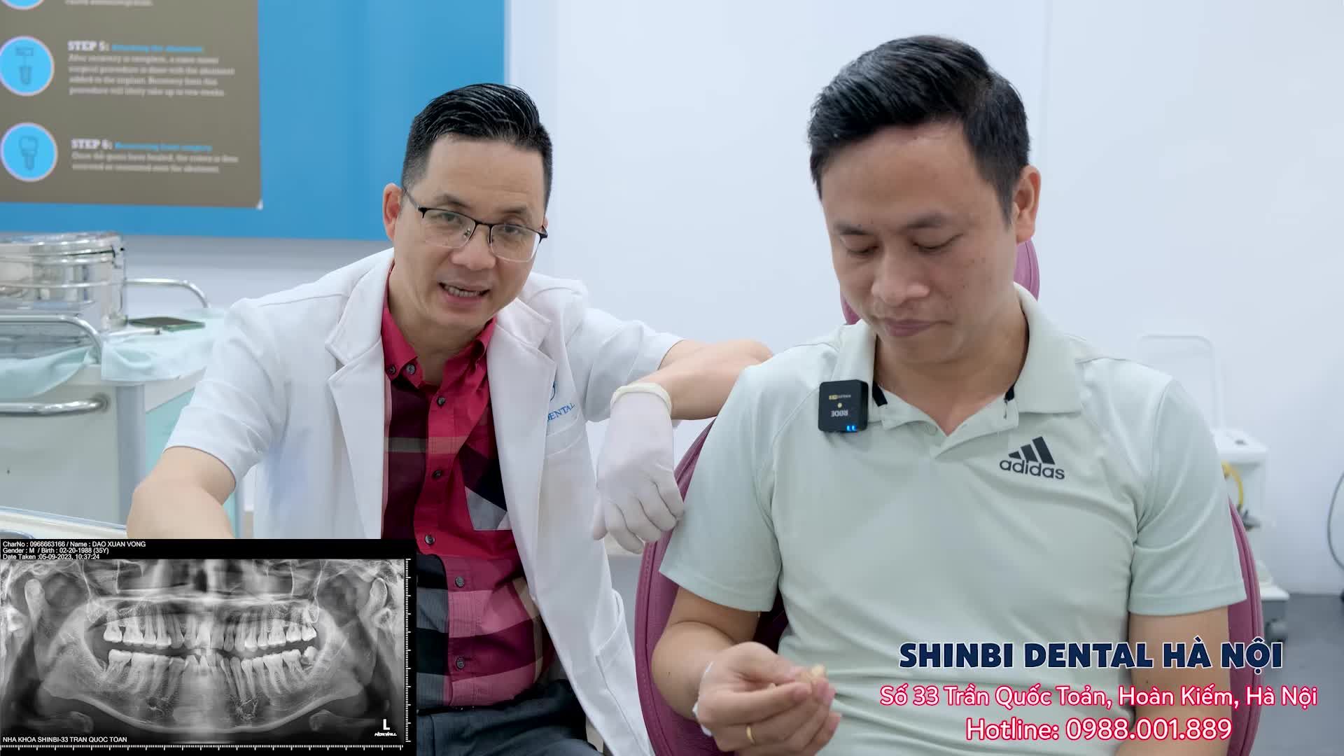 Nhổ răng an toàn - nhanh - gọn - không đau cùng bác sĩ Hòa!