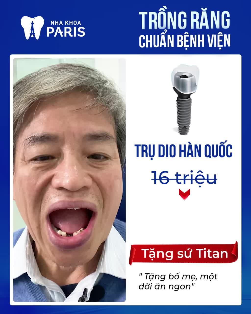 BÙNG NỔ ƯU ĐÃI TRỒNG RĂNG LỚN NHẤT 2023
