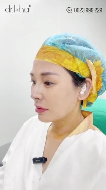 KHÁCH HÀNG TỰ TI VÌ BỊ CHÊ DÁNG MŨI XẤU NÂNG MŨI CẤU TRÚC - KHẮC PHỤC MŨI KHOẰM