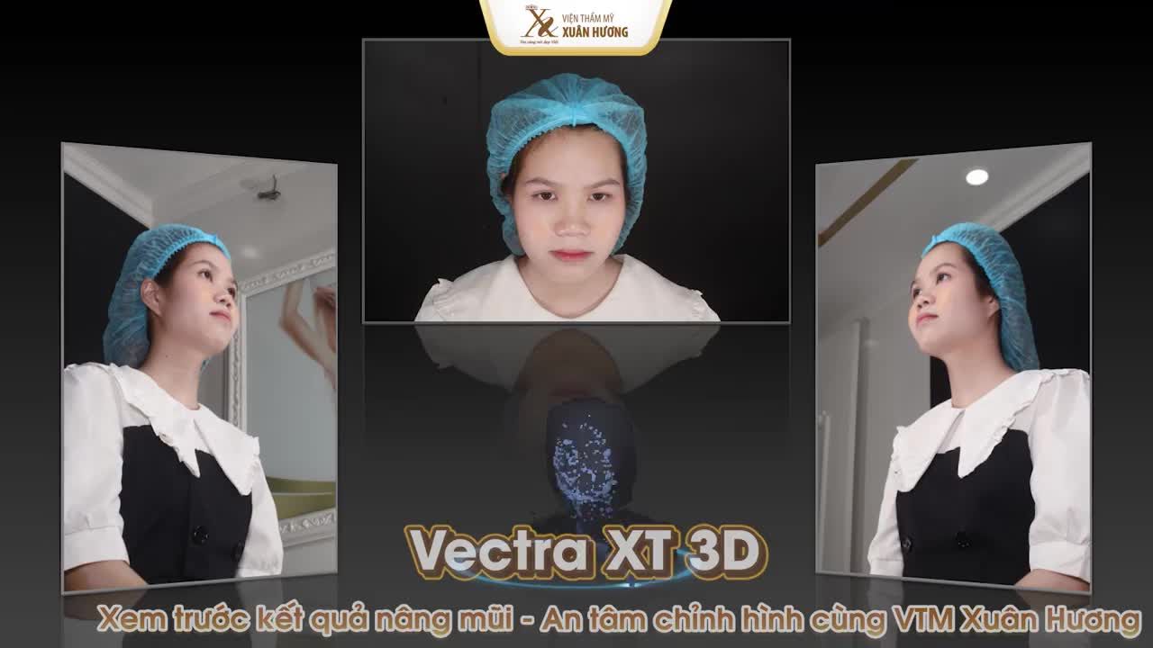 Xem trước kết quả phẫu thuật cùng VTM Xuân Hương