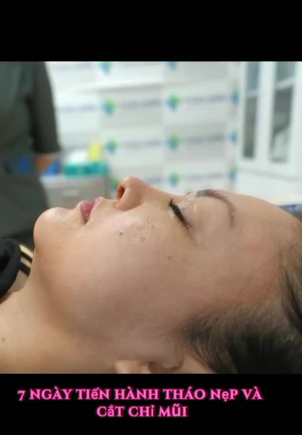 Dừng lại vài giây Ngắm ngay dáng mũi này!