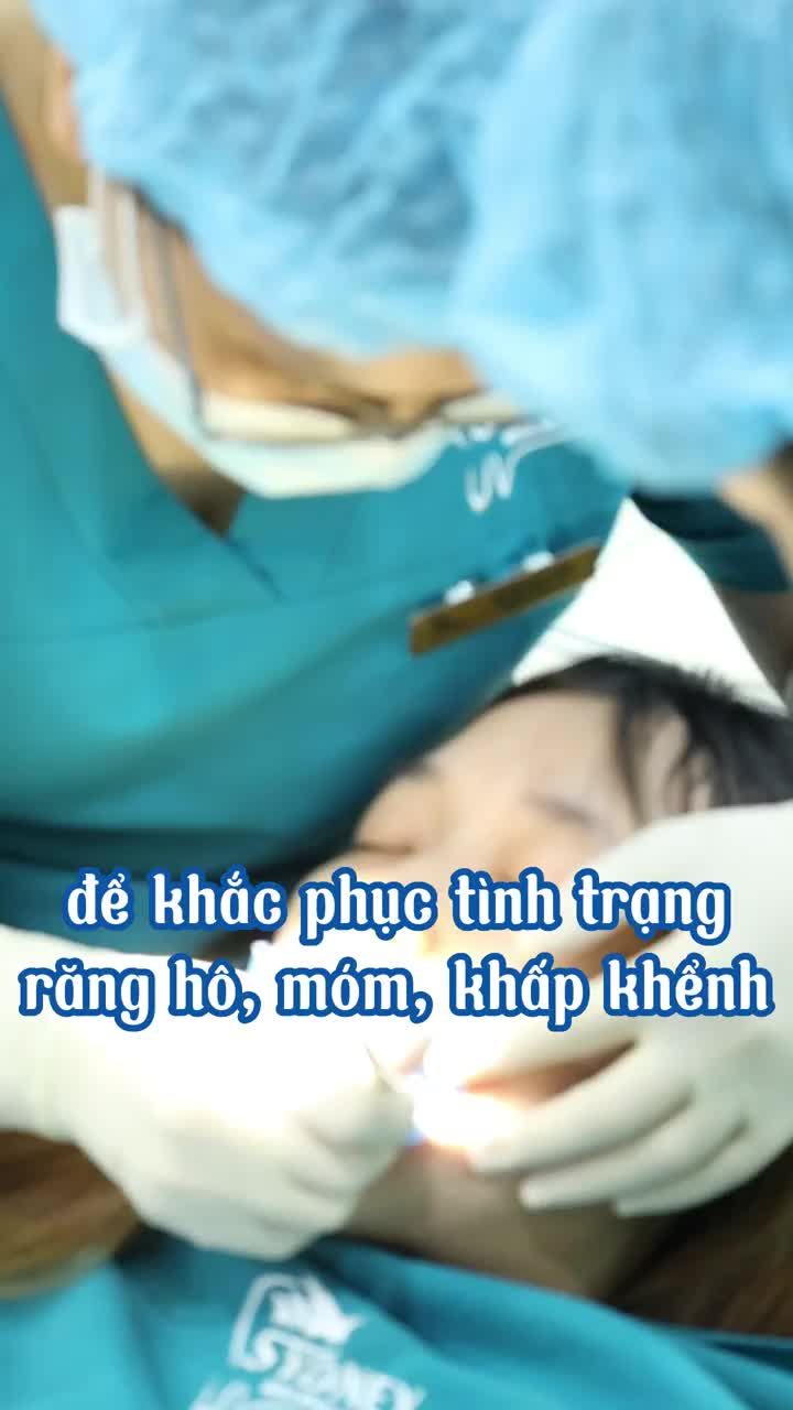 Niềng 2 răng cửa có hiệu quả hay không?