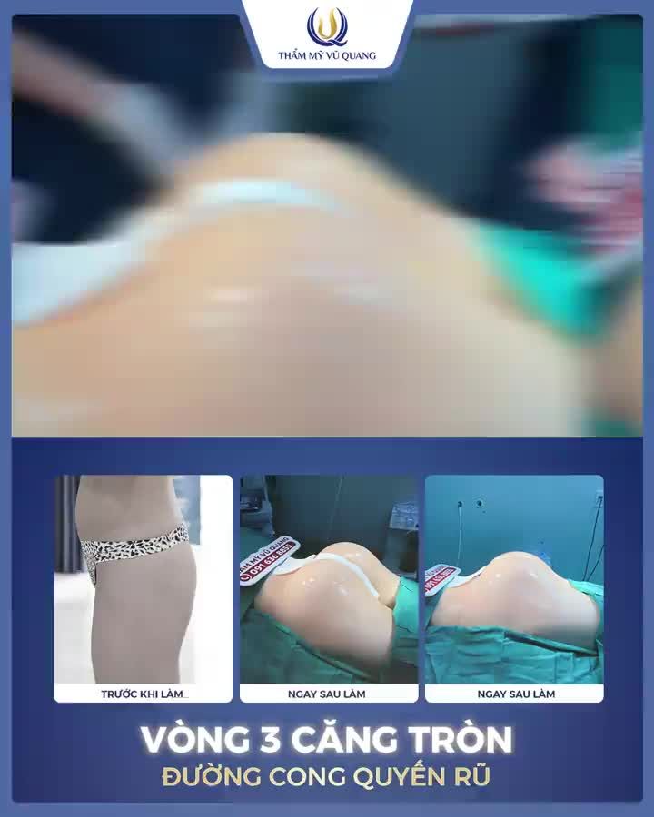 Mông đào căng mẩy - Diện bikini hết sẩy