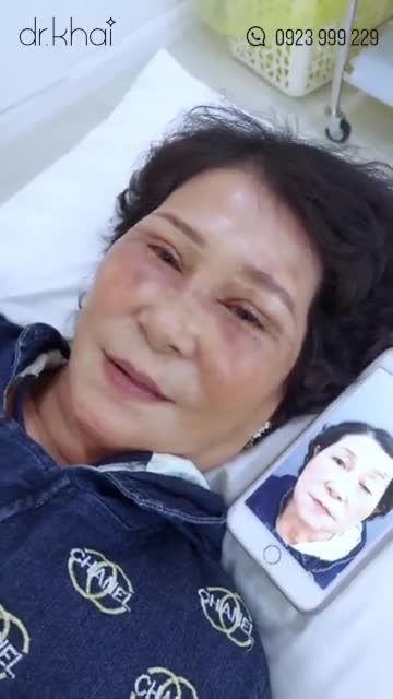 TÁI KHÁM 5 NGÀY CẮT MÍ TRÊN - CHỈNH CƠ NÂNG MI  ĐÔI MẮT ĐẸP SAU 60 NĂM CHỜ ĐỢI