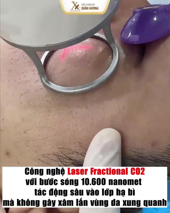 Với Xuân Hương thì mọi vấn đề về da đều có cách giải quyết vì các công nghệ hiện đại đều được chuyển giao chính hãng.