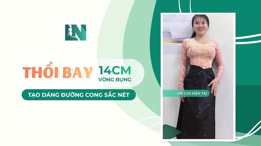 Sau lựa chọn thực hiện combo hút mỡ tạo dáng thẩm mỹ: bụng, kết hợp cấy mỡ tạo dáng, Chị Mai (34 tuổi) của hiện tại đã tự tin mặc những trang phục mà từ trước đến nay, mặc dù mong ước nhưng chưa từng dám thử.