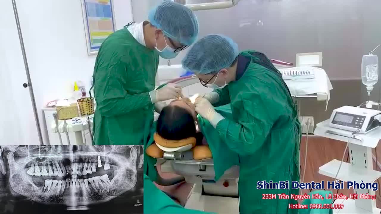 Ca gắn Implant cho chị Hoa - vị khách quen của Shinbi Dental Hải Phòng!