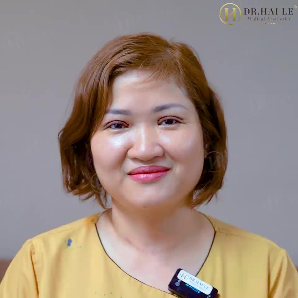 Xua tan tự ti vì đôi mắt 1 mí, bạn tự tin hơn với nếp mí đều đẹp, sắc nét!