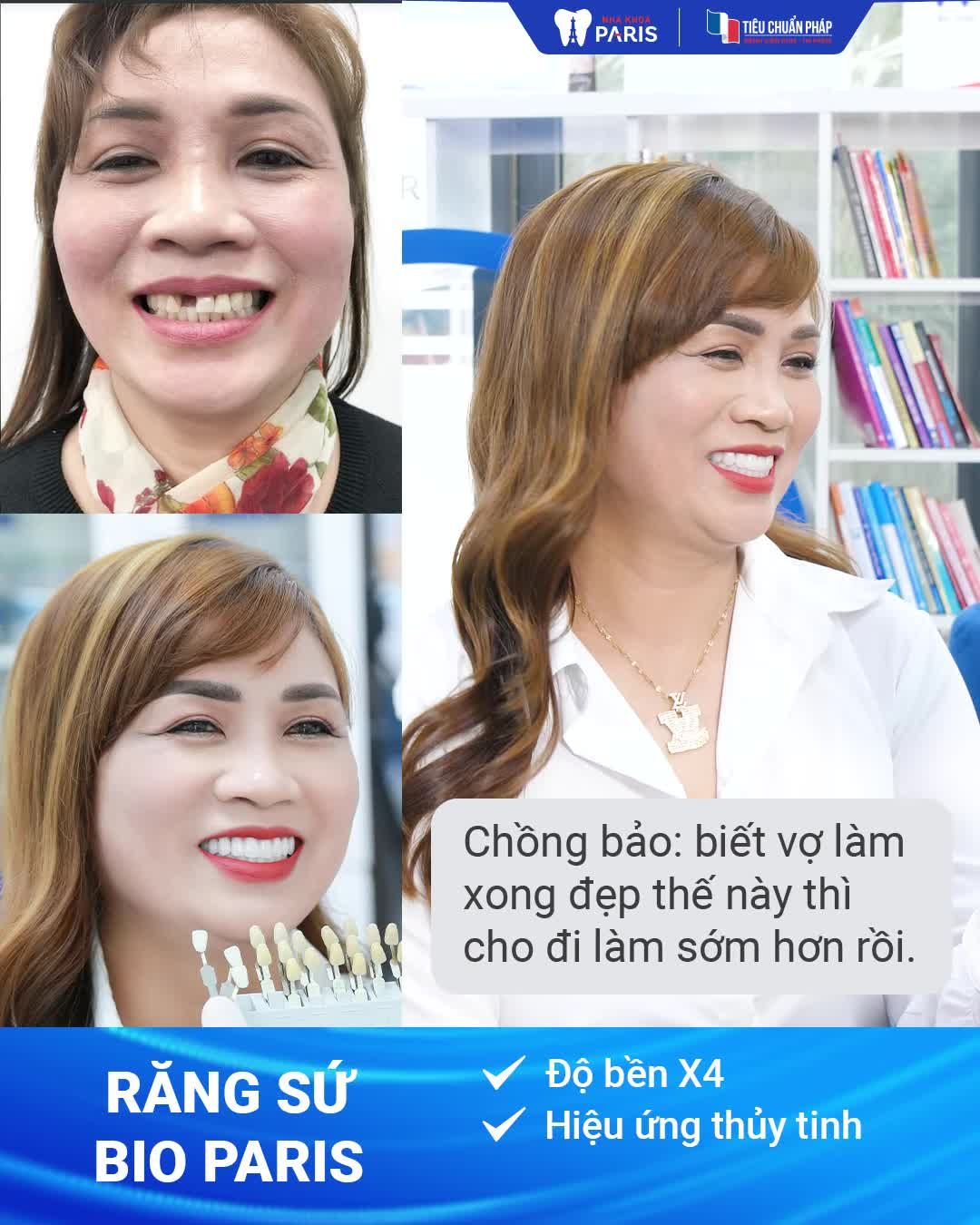 Chọn răng sứ tốt - Bền đẹp 40 năm