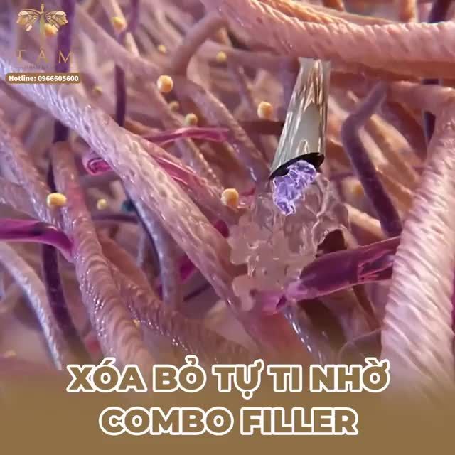 “Cảm ơn Tấm vì đã cho mình sự xinh đẹp và tự tin này” là câu nói của bạn khách Mai Hạnh sau khi trải nghiệm xong dịch vụ filler má, cằm bên Tấm.
