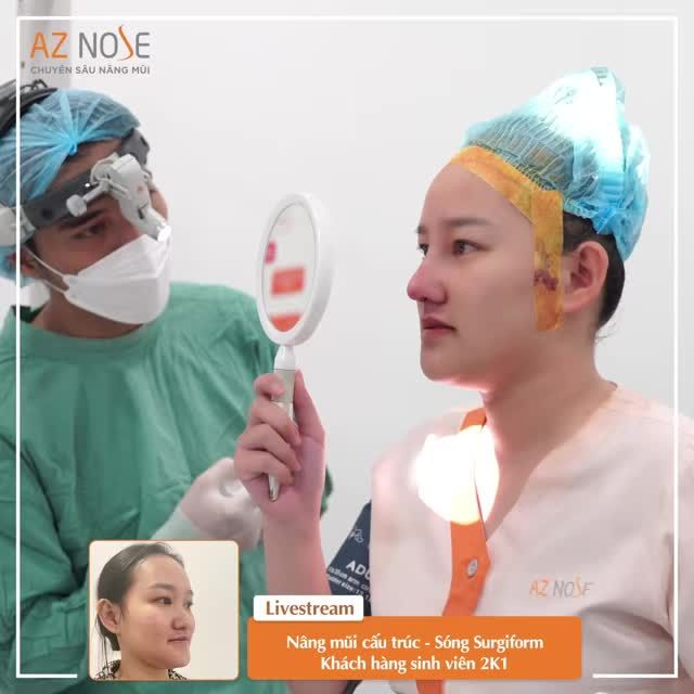 Dáng mũi mới giúp đường nét gương mặt hài hoà, khuôn miệng đẹp hơn