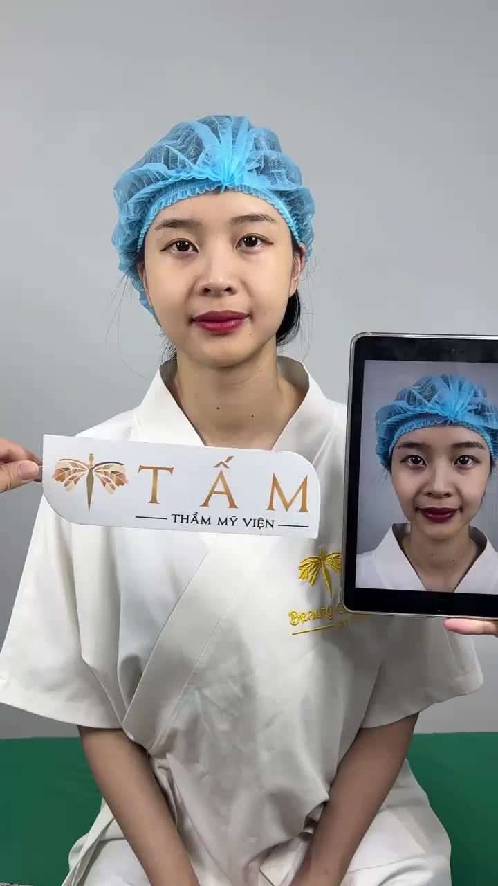 Cập nhật hình ảnh ngay sau làm dịch vụ filler má của khách hàng tại Tấm.
