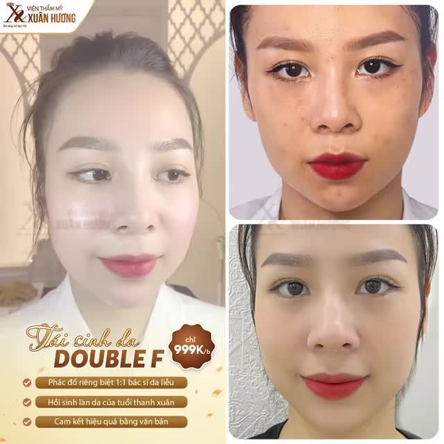 SỞ HỮU DA XINH MÀ KHÔNG MẤT NHIỀU CÔNG CHĂM SÓC